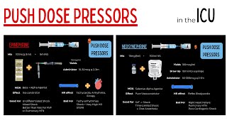 Push Dose Vasopressors For Management Of Shock In The ICU