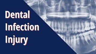 Dental Infection Injury