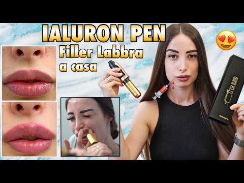 🇮🇹 FILLER LABBRA A CASA 💉 IALURON PEN 👄  Auto iniezione di acido ialuronico a casa