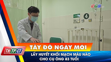 Lấy huyết khối mạch máu não cho cụ ông 83 tuổi | Cần Thơ TV