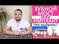 Зубной мост или имплант? Что выбрать? В каких случаях ставить, преимущества зубного импланта.