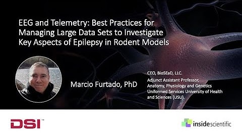 EEG and Telemetry: Managing Large Data Sets to Investigate Key Aspects of Epilepsy in Rodent Models