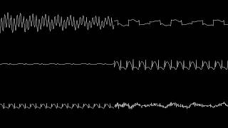 Puggsy - Darkblade Forest (oscilloscope)