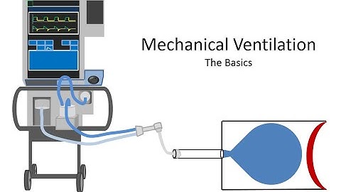 Mechanical Ventilation - The Basics