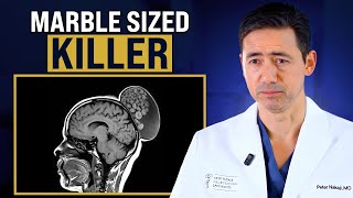 The Marble-Sized Killer Inside Your Brain