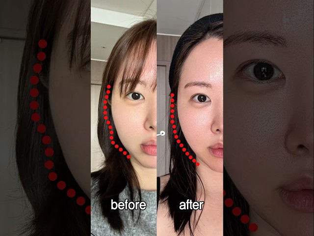 미친 리프팅 리얼 찐후기 올타이트 편
