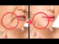 30 minantiaging face exercise to reduce marionette lines lift droopy mouth corners sagging jowl