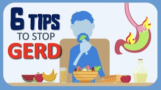 How to stop GERD. Treatment of Acid Reflux