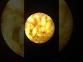 Как Пчелу Осмию Съели Личинки Мух Паразитов? Мухи Cacoxenus indagator (Drosophilidae). #shorts