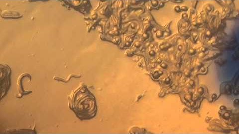 C . Elegans Video Lab Report