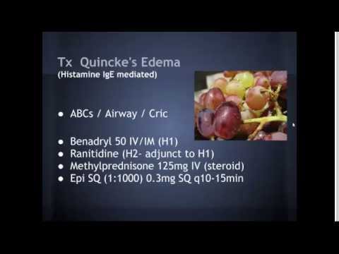 Video: Quincke's Edema - Causes, Symptoms And Treatment Of Quincke's Edema. First Aid
