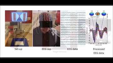 Freezing of Gait (FoG) in Parkinson