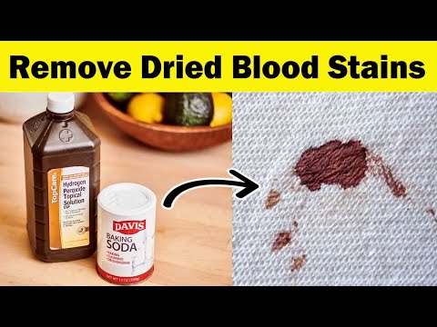 How to Remove Dried and Fresh Blood Stains - Dengarden