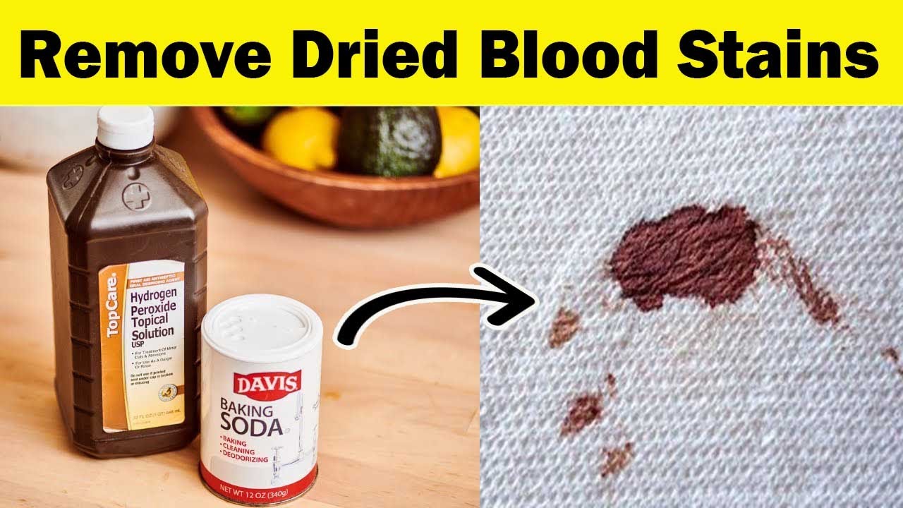 How to remove dried blood stains from carpet and clothes 