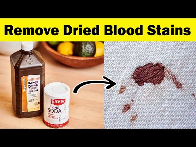 How to remove dried blood stains from carpet and clothes 