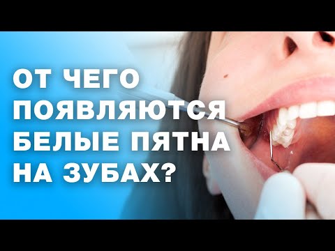 Почему появляются пятна на зубах? Как избавиться от пятен на зубах?