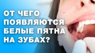 Почему появляются пятна на зубах? Как избавиться от пятен на зубах?