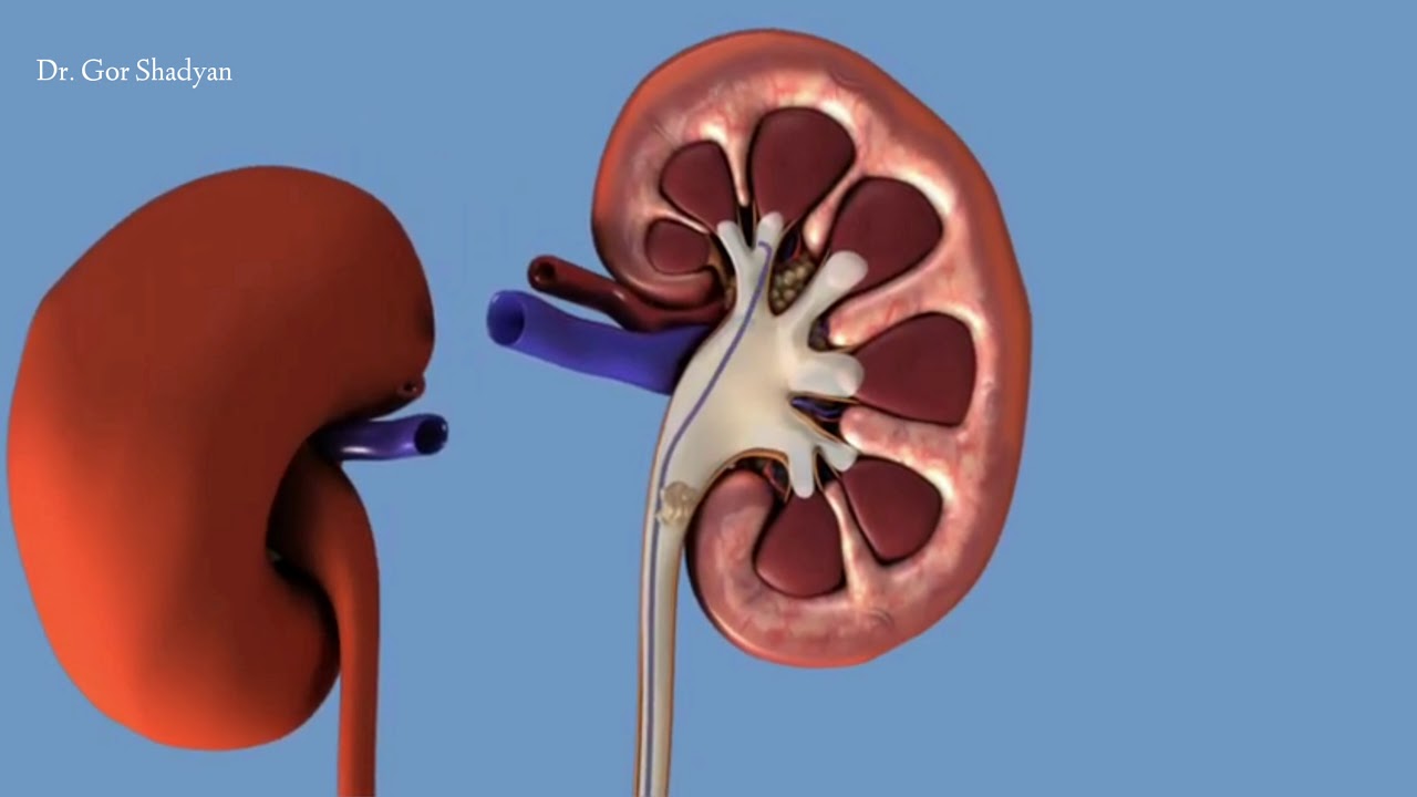 Միզածորանի սթենտավորում։ Ներկայացնում է ուրոլոգ Գոռ Շադյանը։ Հեռ.` 094334199։