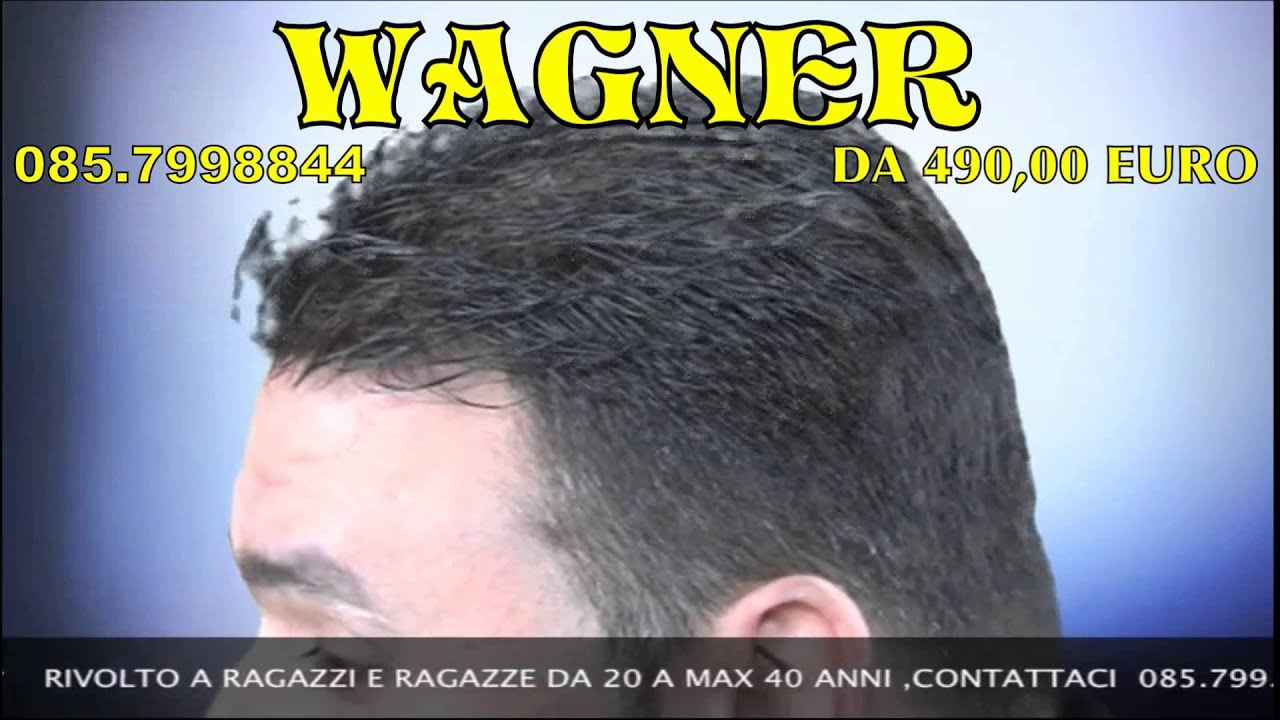 protesi capelli wagner