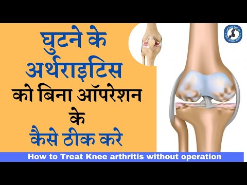 वीडियो: फूलगोभी के कान सुखाने के 3 तरीके