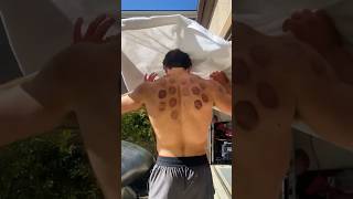 What are those spots on my back? #icebath #duet #verycold #dangerous #funny #iceberg