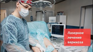 Лазерное лечение варикозного расширения вен в Клинике Доктора Фомина. Метод ЭВЛО/ЭВЛК