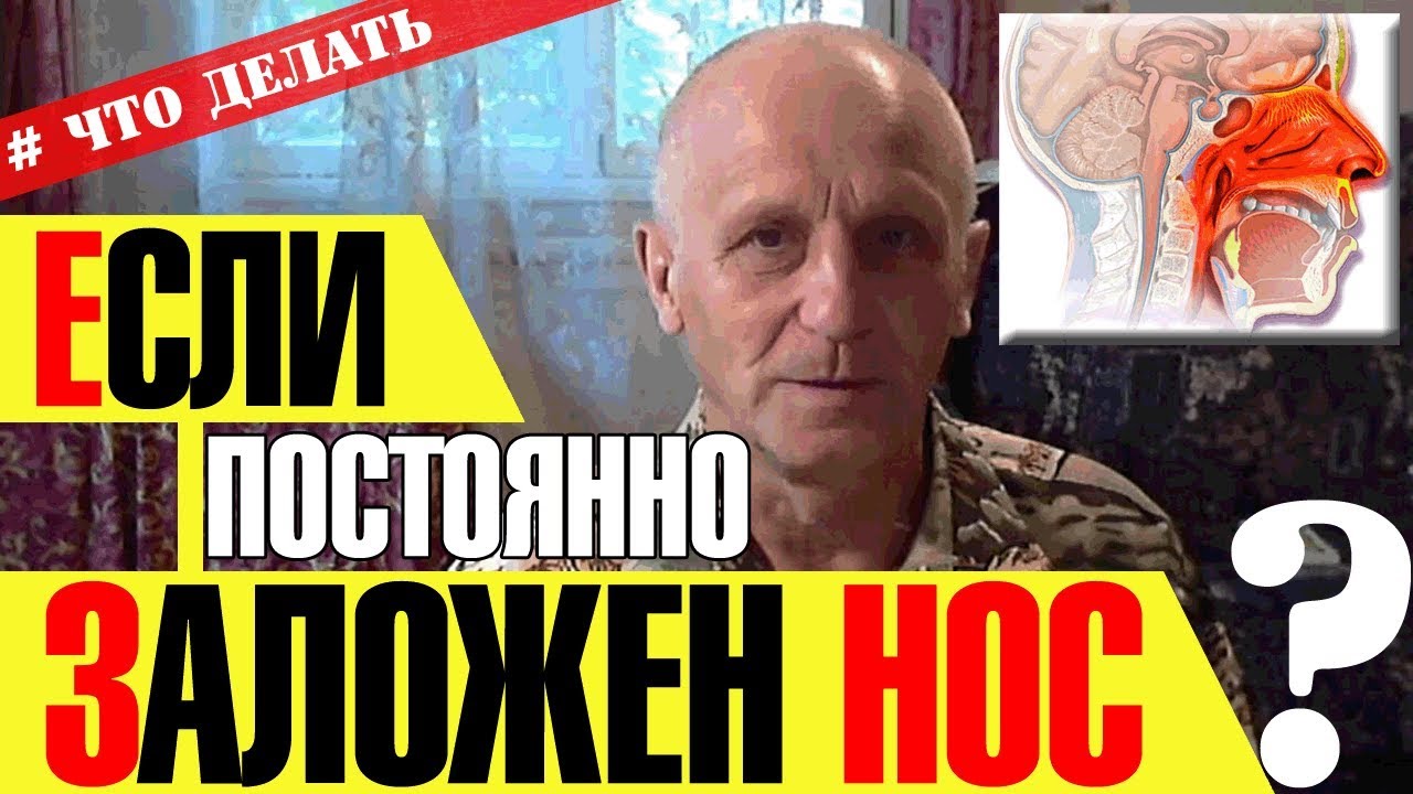КАК ВЫЛЕЧИТЬ ХРОНИЧЕСКИЙ НАСМОРК? - YouTube