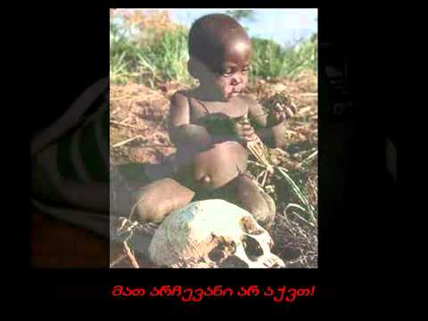 არის ისეთი რამ რაც გაღიზიანებთ?