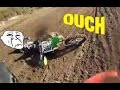 MX Broken Leg Crash