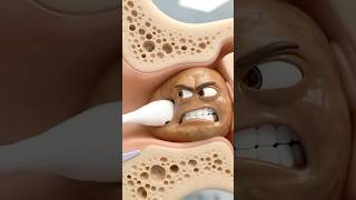 Stop Using Q-Tips! Watch What Happens 👂