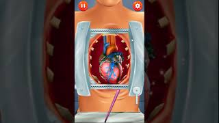 ER Emergency Heart Repair(surgentry) Game ... screenshot 2