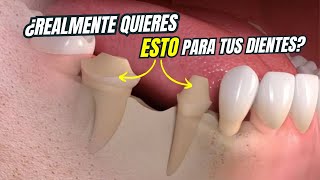 Lo peor que un dentista le puede hacer a su paciente by Dr. Federico Baena Q 24,562 views 2 weeks ago 6 minutes, 9 seconds