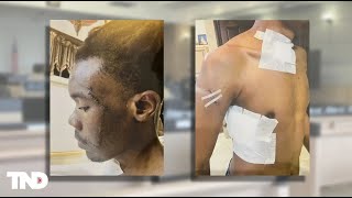Lyft driver recounts surviving brutal stabbing at trial: 'Fighting for my life'