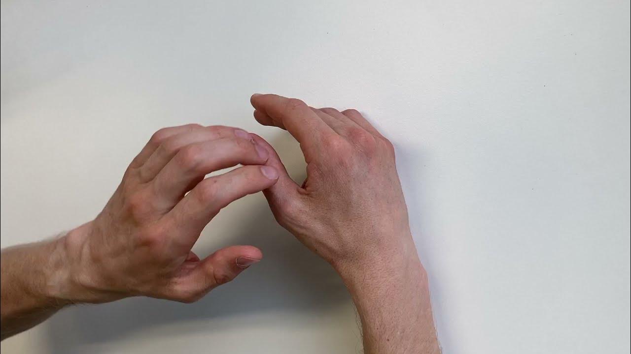 Grind test Selftest for CMC1 arthrosis YouTube