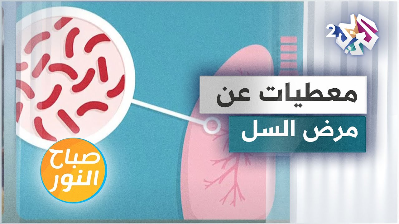مرض السل.. الأسباب والوقاية والعلاجات