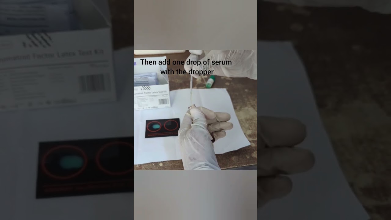 How To Do RA Test (Rhematoid Arthritis) By Latex Agglutination Method 