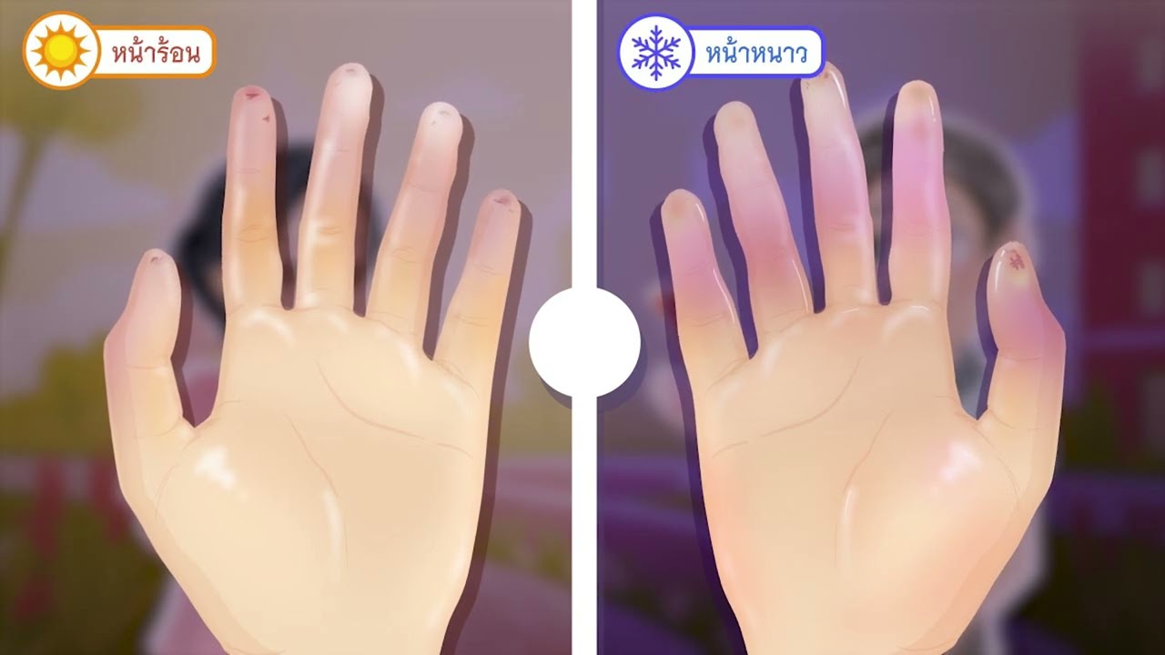 EP21 ยาขยายหลอดเลือดที่ใช้รักษาโรคหนังแข็ง