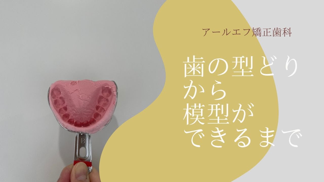 【歯の型どり】歯の型どりから模型ができるまで••/ｱｰﾙｴﾌ矯正歯科/ｲﾝﾋﾞｻﾞﾗｲﾝ/東京/ﾏｳｽﾋﾟｰｽ矯正