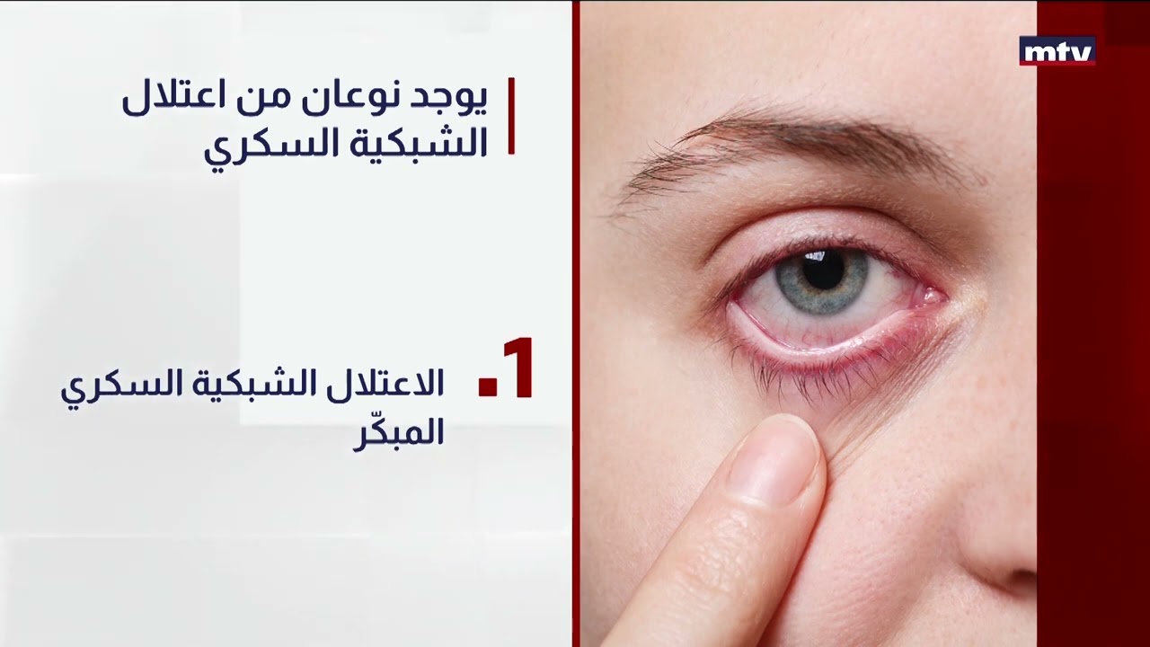 Diabetic Retinopathy: How Diabetes affects your eyesight.