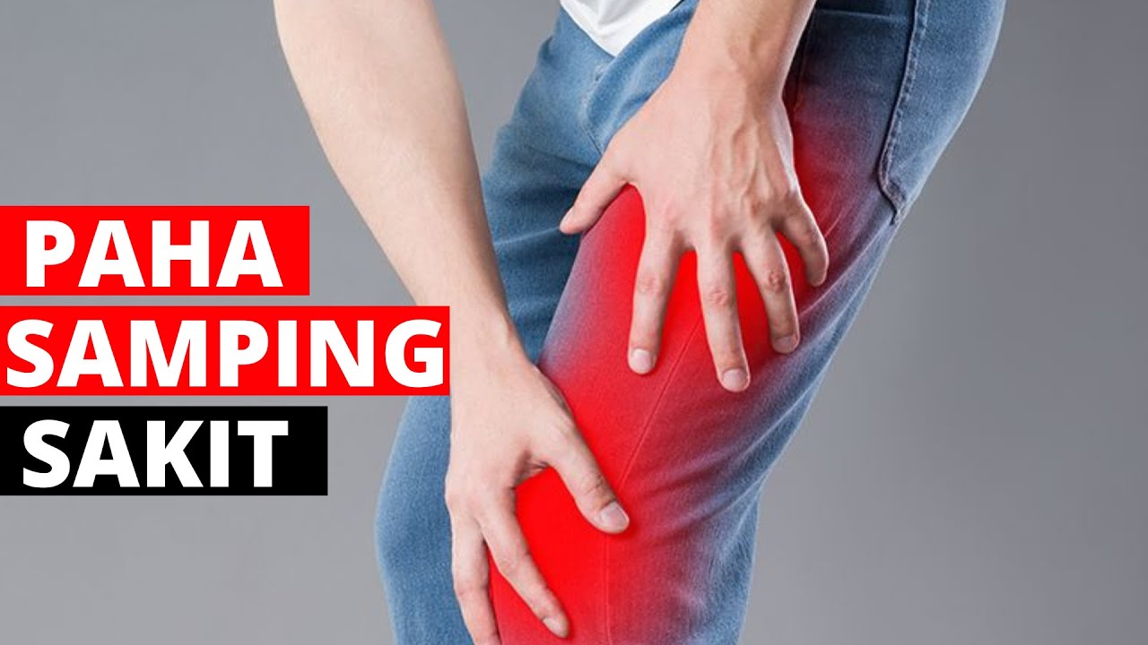 Cara mengatasi otot paha samping bengkak