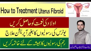 How To Treatment Uterus Fibroid. Reham ke Rasoliyo ka ilaj. Uterus ke Rasoli ka ilaj in Urdu