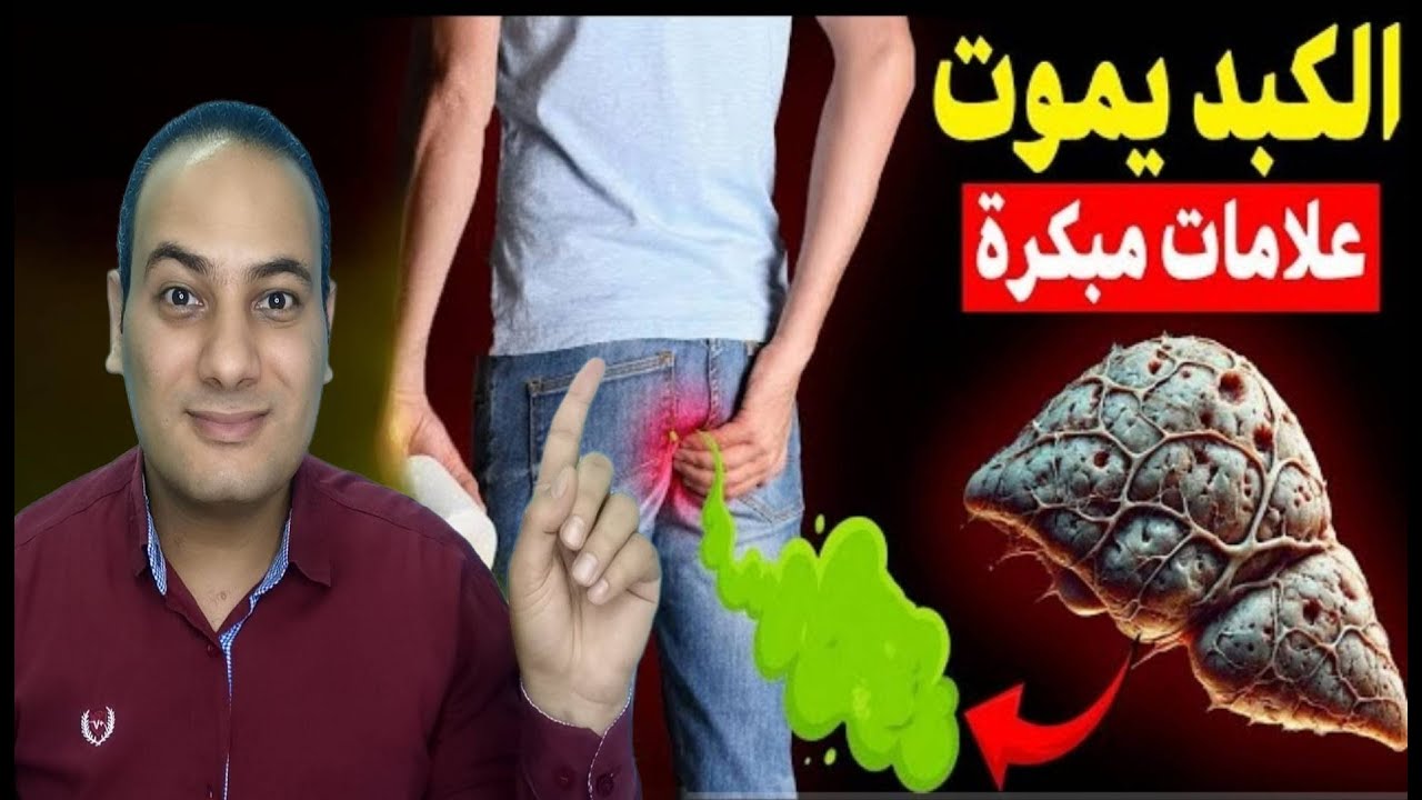 انتبه: 12 عرض تدل على تلف الكبد يجب الحذر منها قبل فوات الأوان/كيف تعكس تلف الكبد وازاله السموم منه