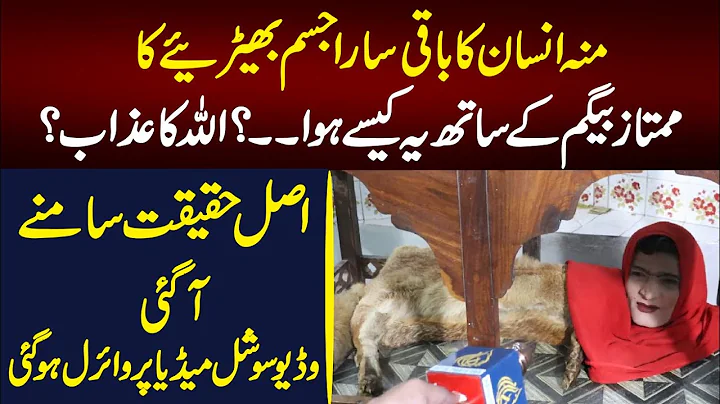 Meet Mumtaz Begum In Karachi Zoo: Half Human & Hal...