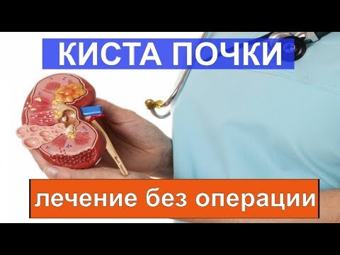 Кисты почек КАК  избавиться без операции
