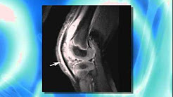 Orthopedics: Septic Arthritis in Children