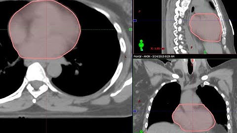 Eclipse Contouring Series: Heart (Pericardium)