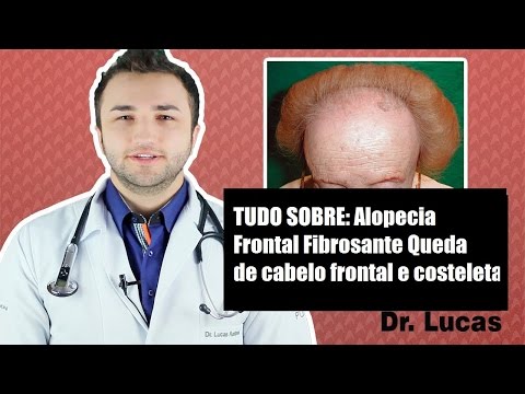 Alopecia Frontal Fibrosante [Queda de cabelo frontal e costeletas] - Dr Lucas Fustinoni