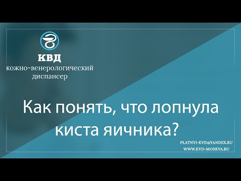 1095  Как понять, что лопнула киста яичника?
