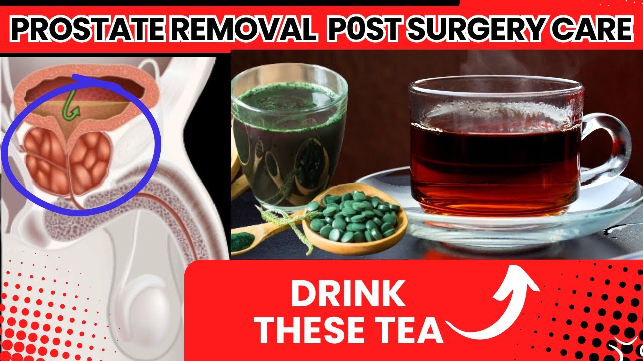 Best Herbal Tea For Post Surgery Prostate Removal Prostate Health