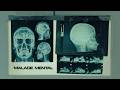 Mouka Malade Mental ft Hanta Ka3bi Official Music Video mp3